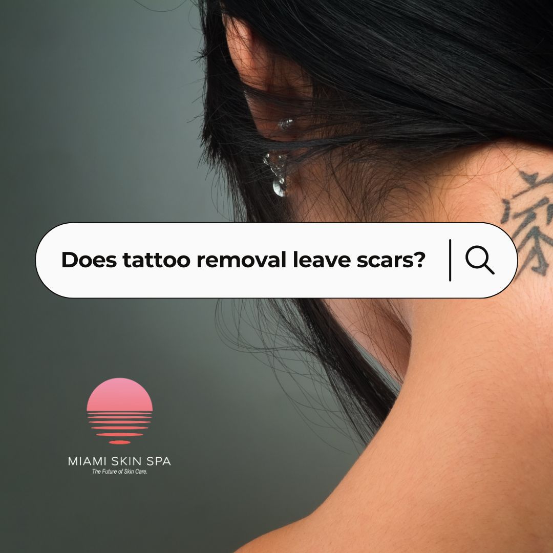 Does Tattoo Removal Leave Scars? at Miami Skin Spa in Brickell