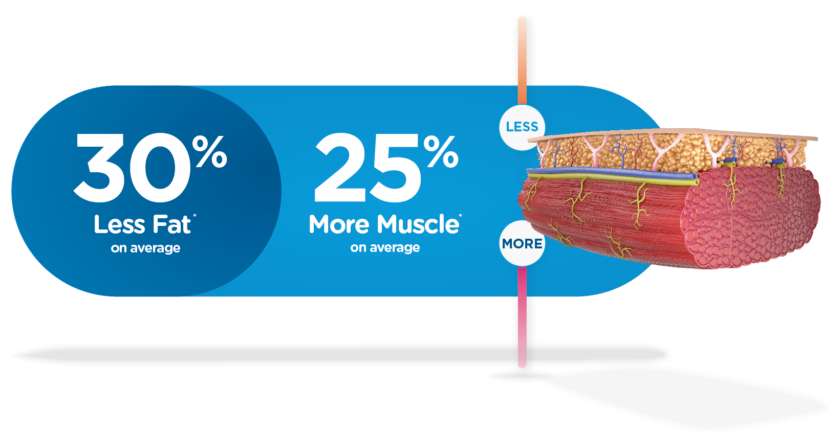 Emsculpt NEO — less fat, more muscle illustration Emsculpt NEO — less fat, more muscle illustration