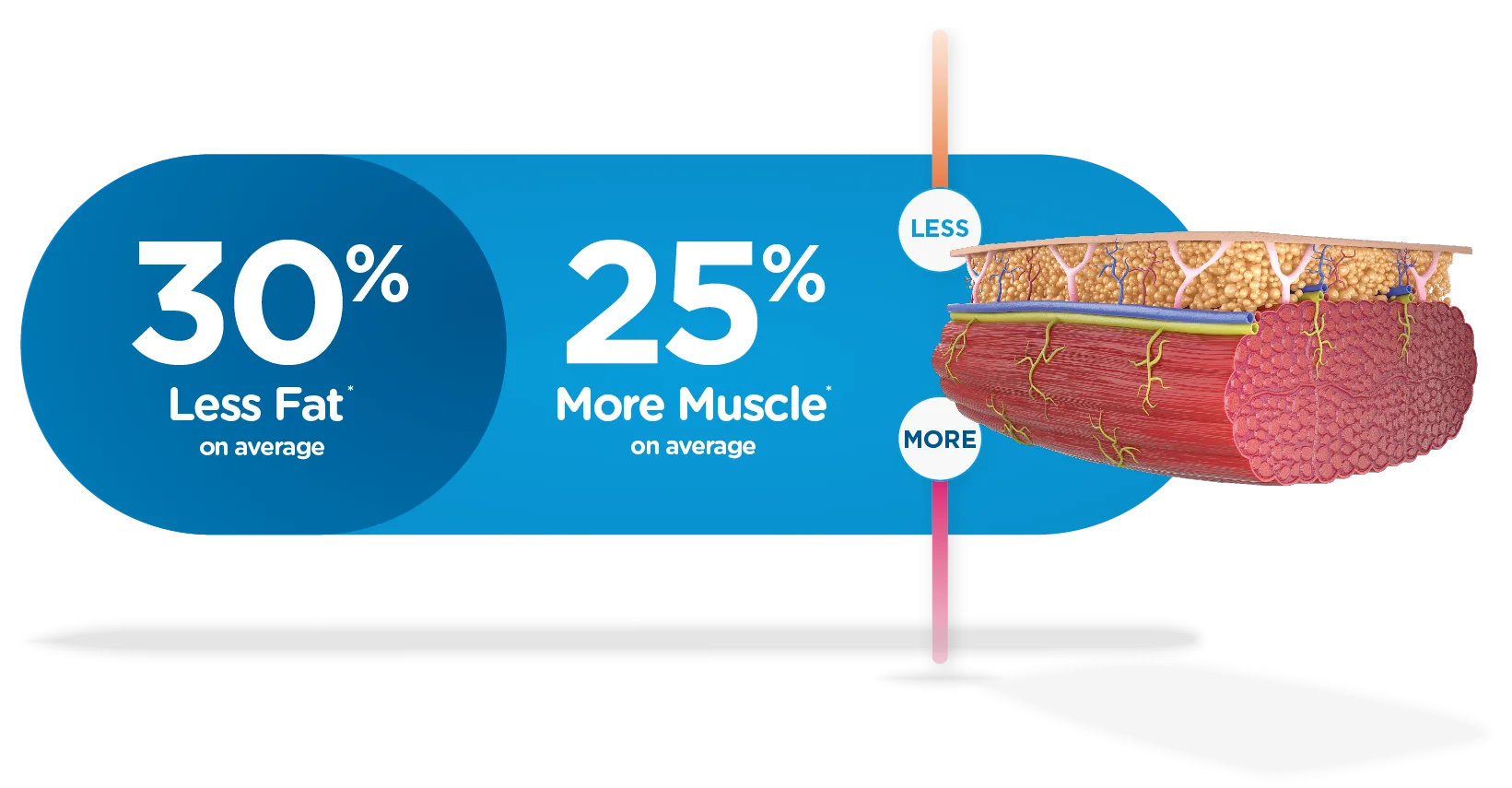 Emsculpt NEO — less fat, more muscle illustration Emsculpt NEO — less fat, more muscle illustration