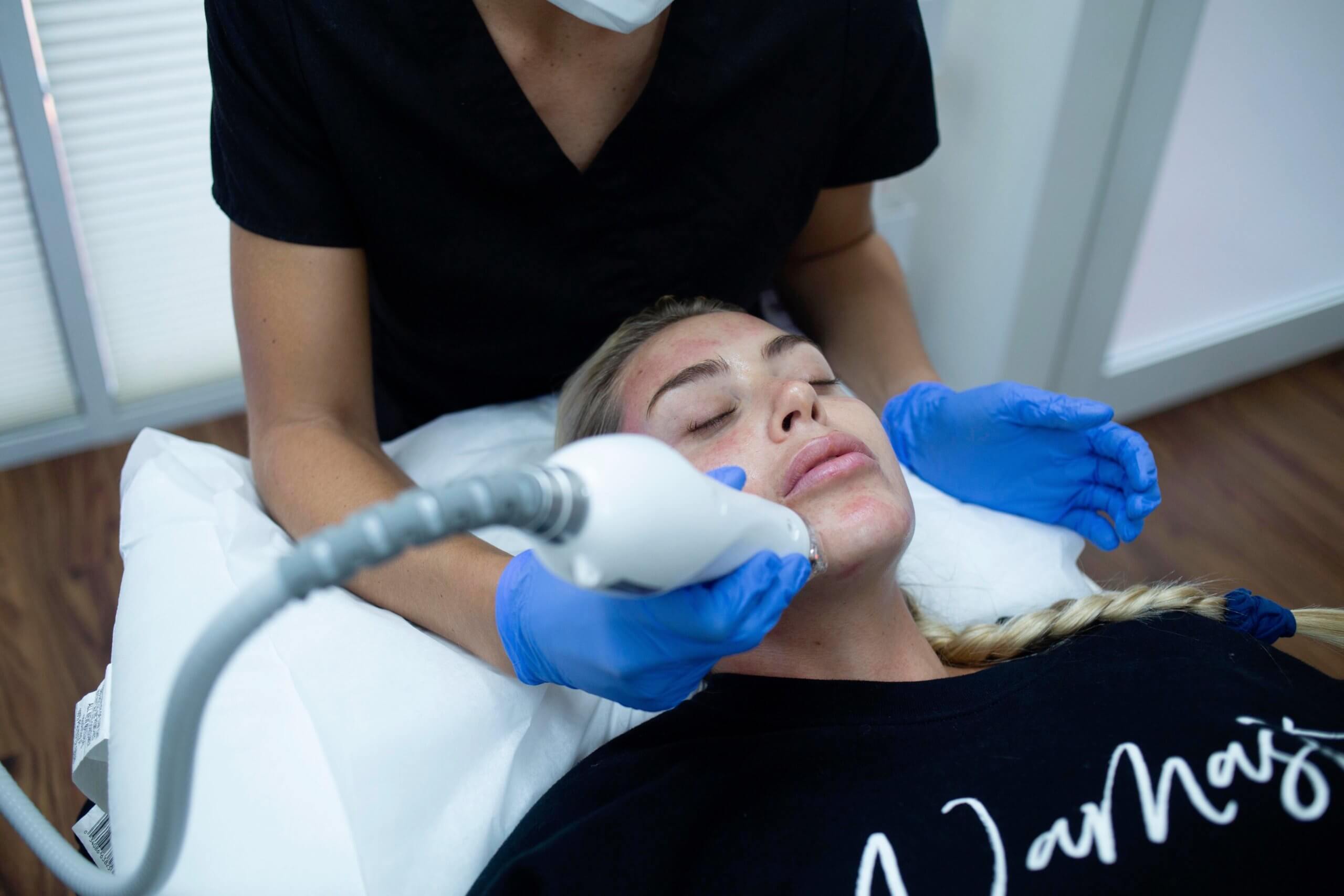 Advantages of RF Microneedling vs. Laser Scar Removal at Miami Skin Spa in Brickell