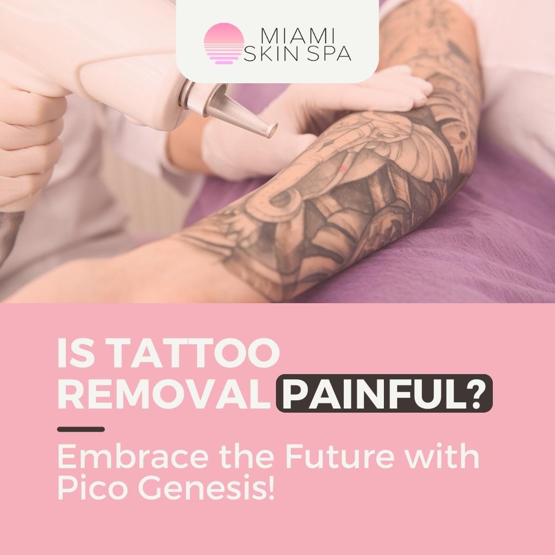 Is Tattoo Removal Painful? at Miami Skin Spa in Brickell