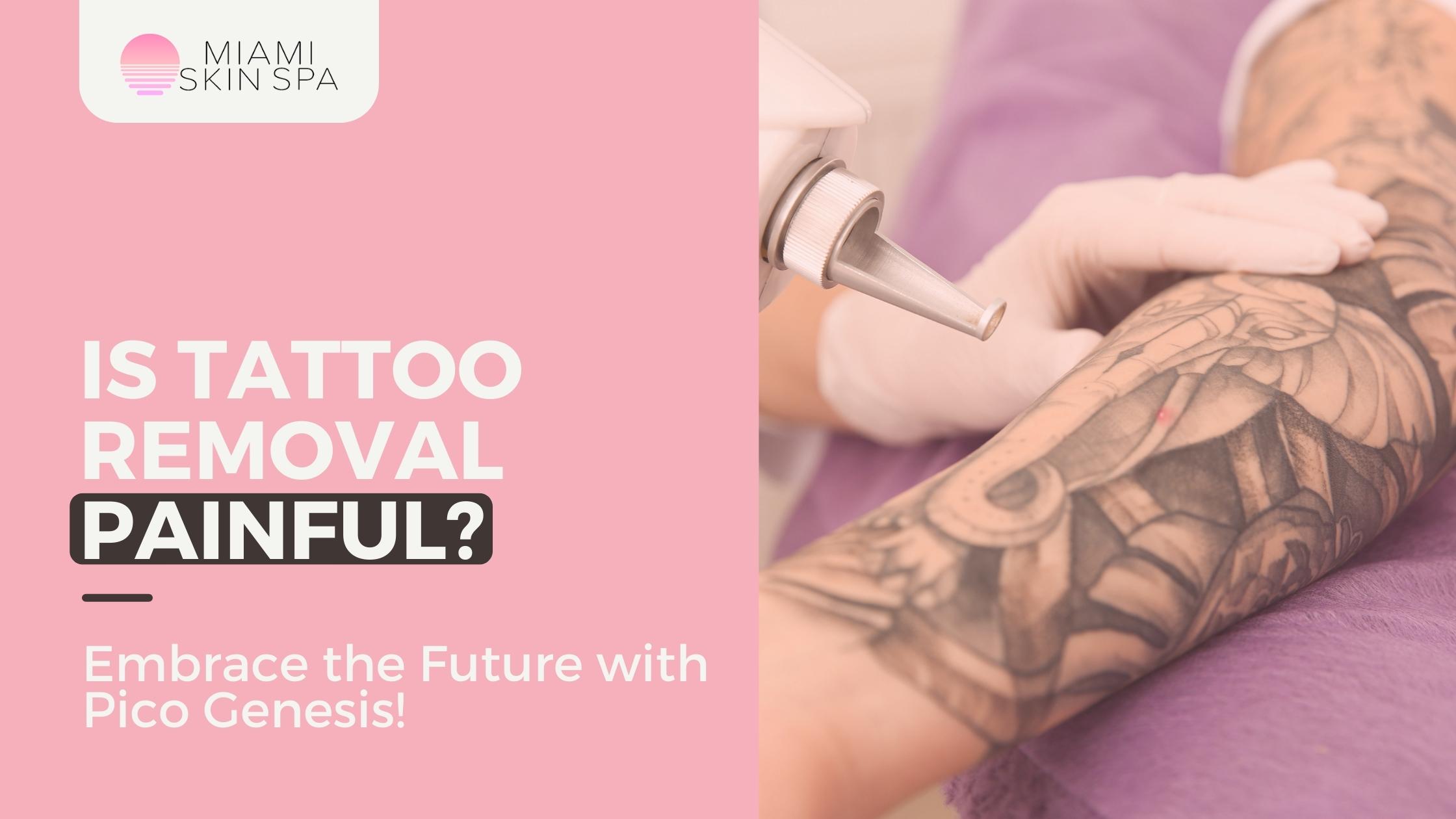 Is Tattoo Removal Painful?