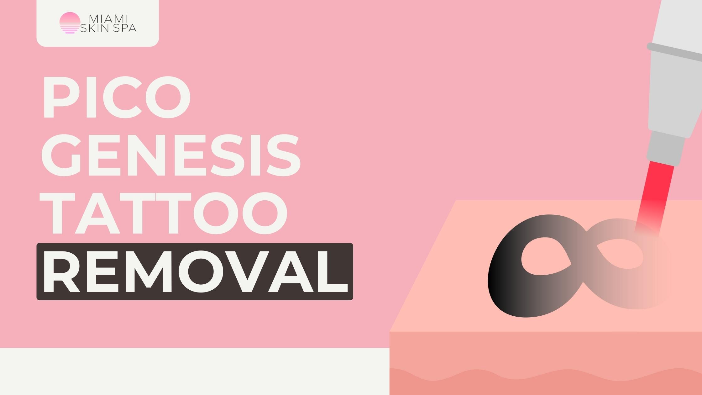 How Long Does Tattoo Removal Take?