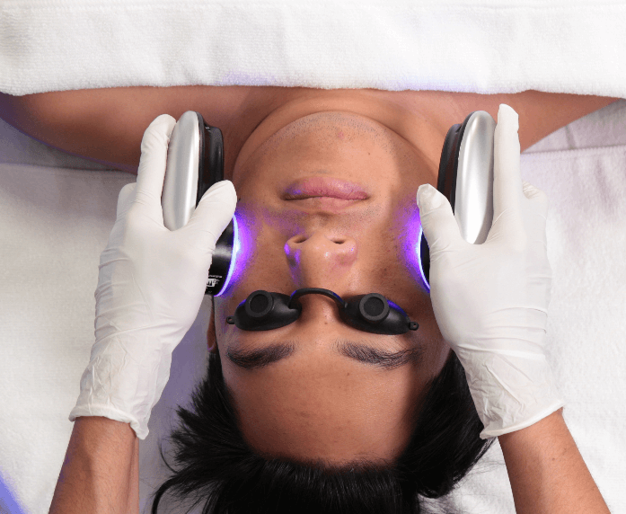 What Is a Chemical Peel? Everything You Need to Know