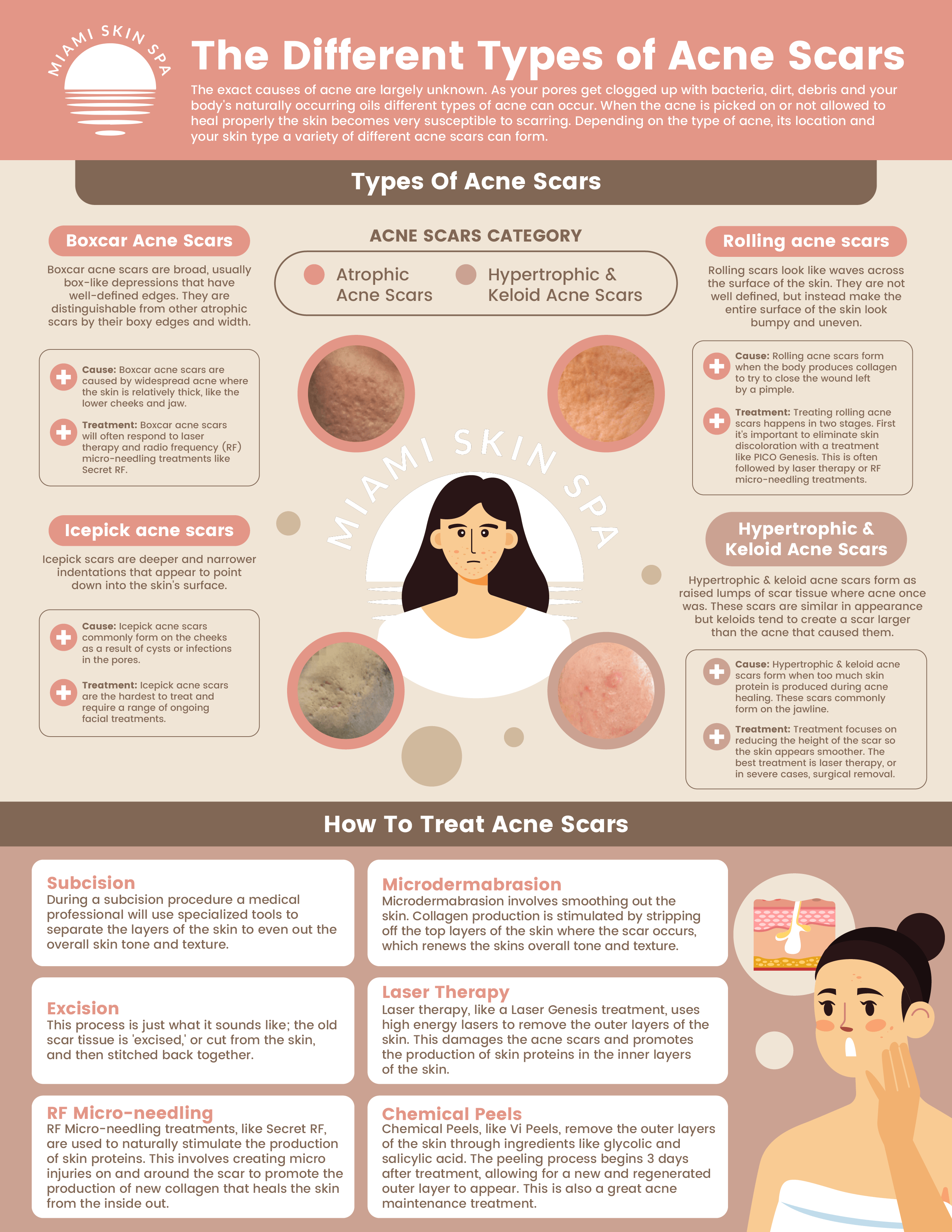 An infographic explaining the different types of acne scars including boxcar, icepick, rolling, and hypertrophic scars with causes and treatments