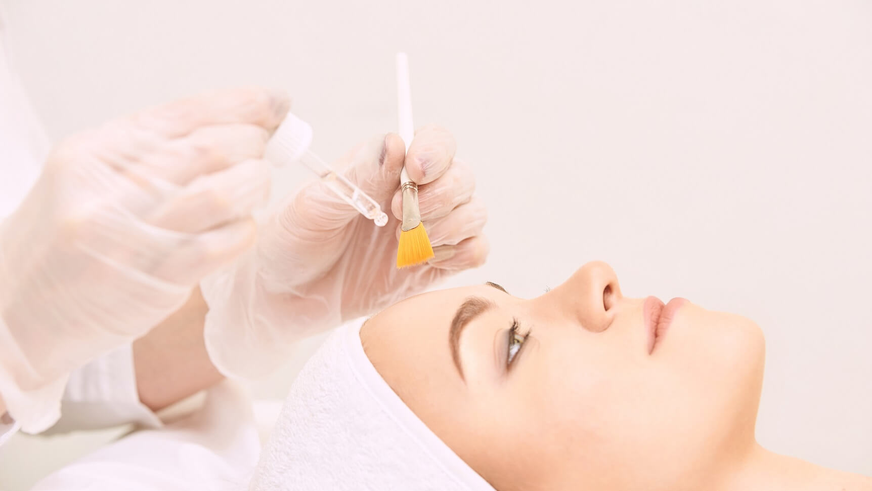 VI Peel at Miami Skin Spa in Brickell — medical-grade chemical peel for acne scars and sun damage