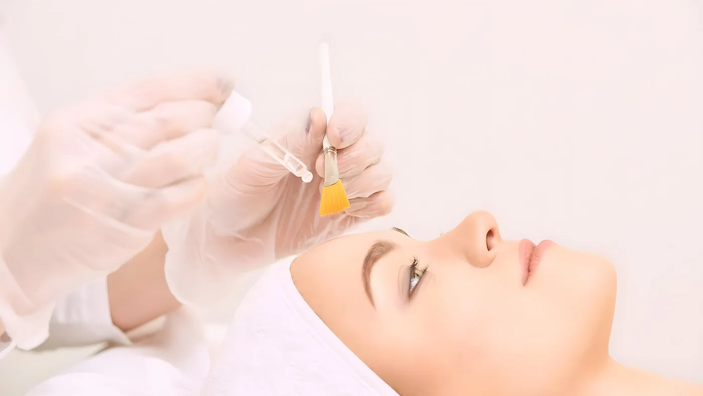 VI Peel at Miami Skin Spa in Brickell — medical-grade chemical peel for acne scars and sun damage