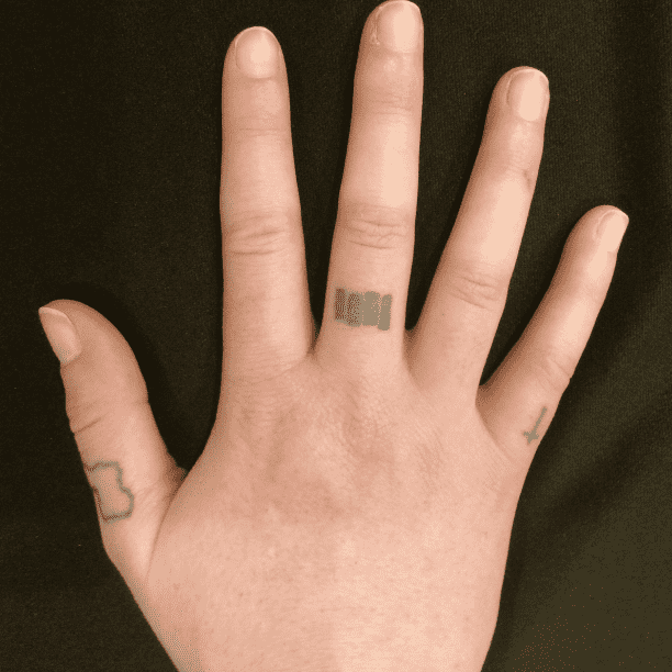 Tattoo before Cutera Enlighten III treatment.