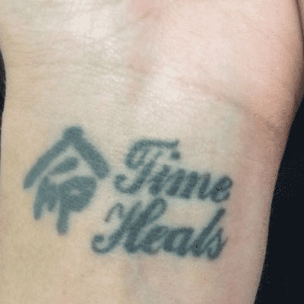 Tattoo before Cutera Enlighten III treatment.