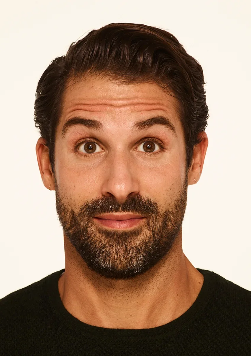 Stephen before Botox — moderate to severe forehead lines
