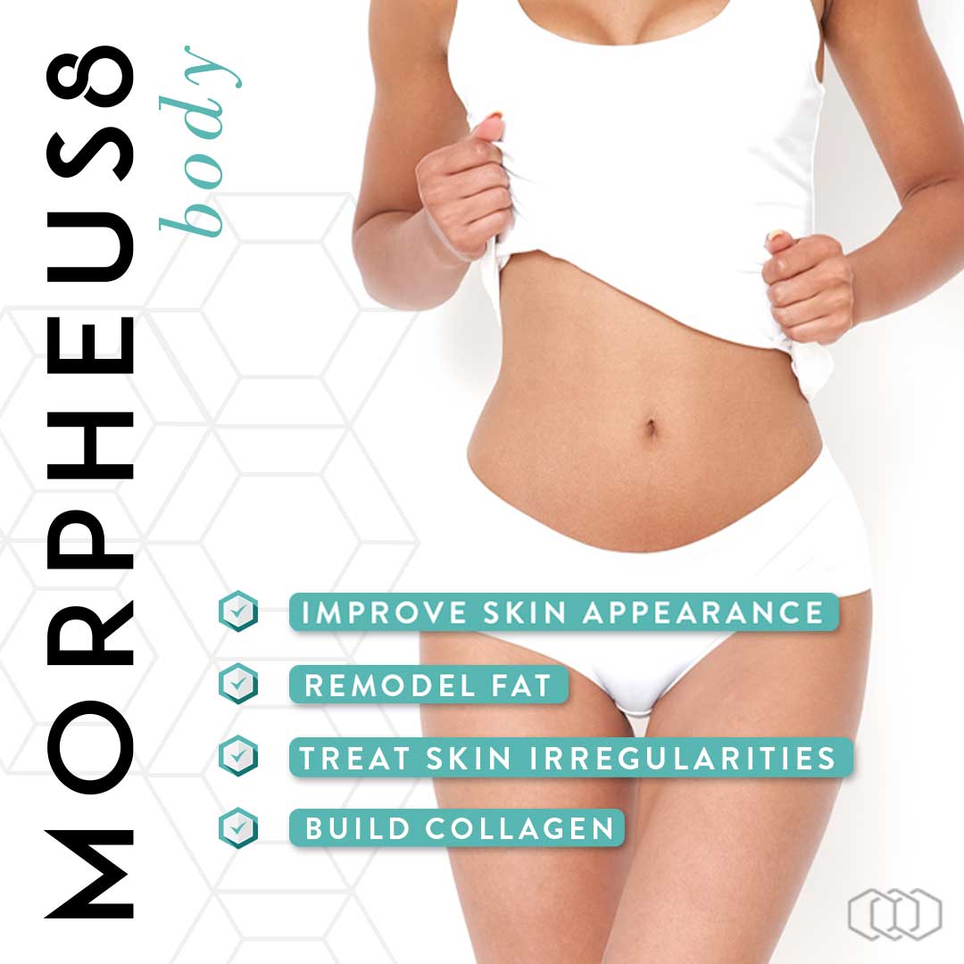 Morpheus8 Body at Miami Skin Spa in Brickell — deep RF microneedling for body contouring