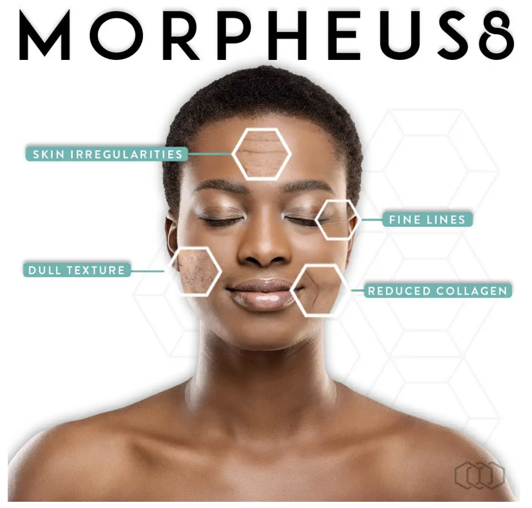 morpheus8 resurfacing