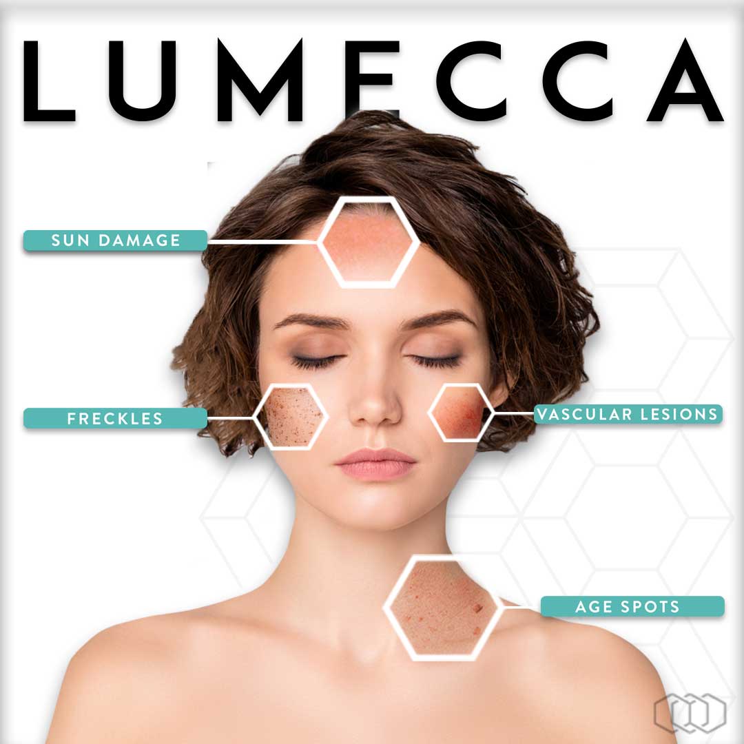 lumecca-infographic-miami-skin-spa